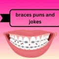 braces puns and jokes